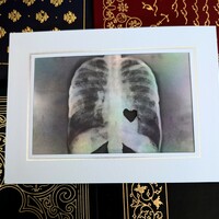 X-Ray Heart Art Print - Thumbnail 1