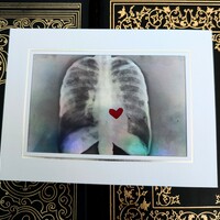 X-Ray Heart Art Print - Thumbnail 3